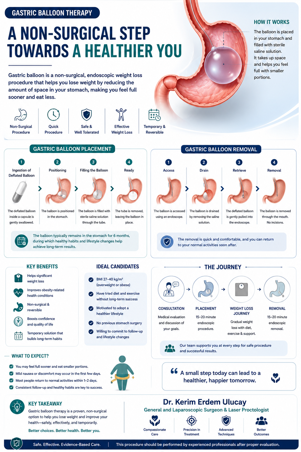 Gastric balloon therapy overview: how it works, placement, removal, key benefits and ideal candidates